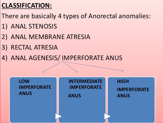 anal malformations ppt Anal malformations ppt